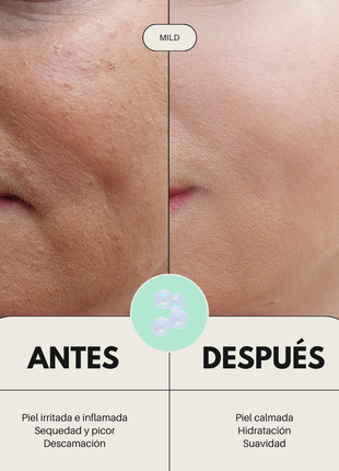 Sérum Facial Calmante Pieles Sensibles con Rojeces MILD